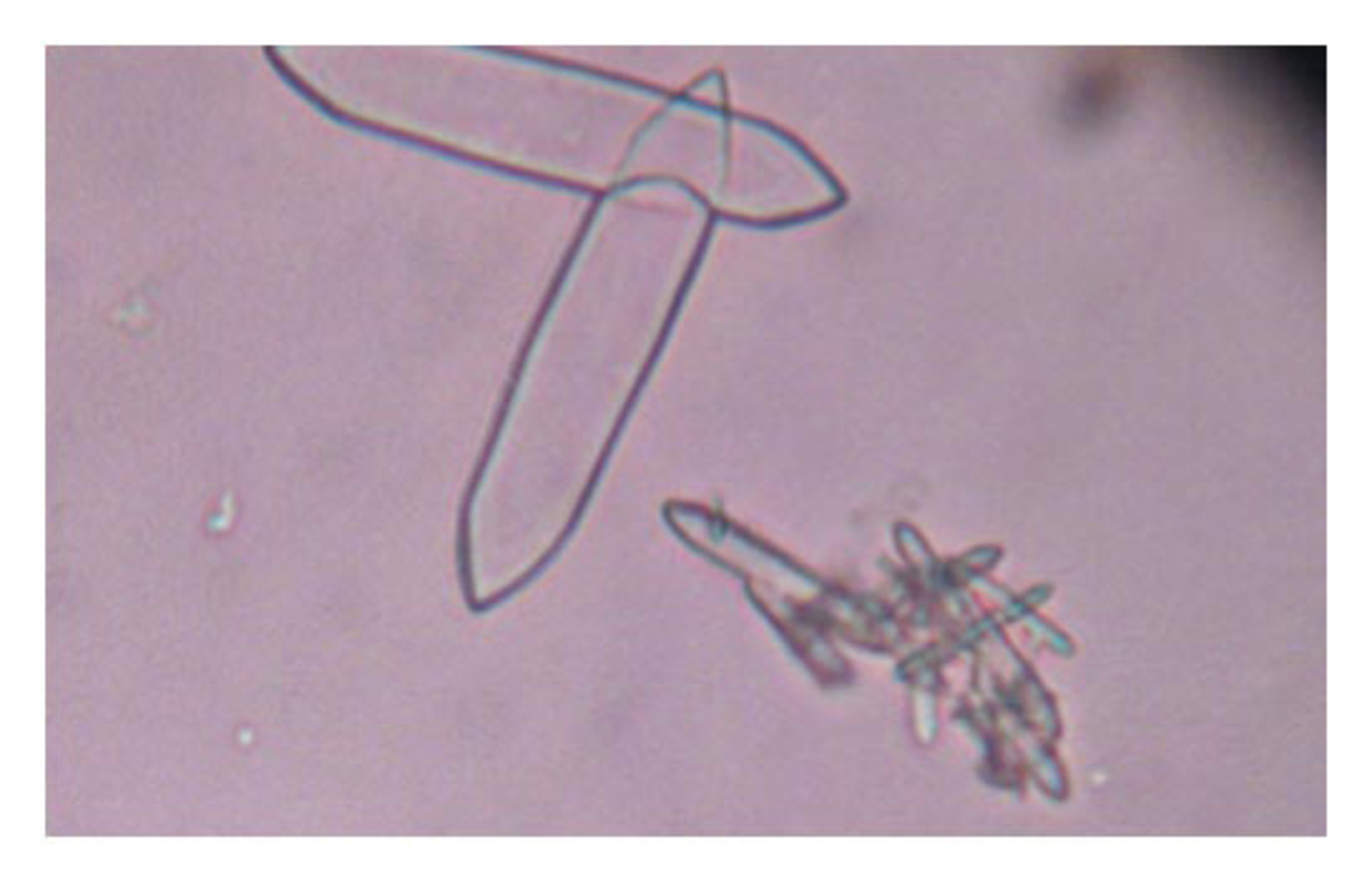 Oxalate