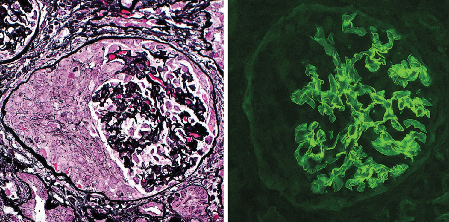 Chest imaging