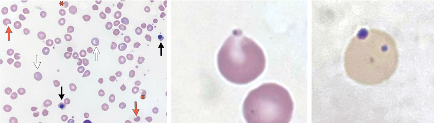 Oxidative Injury