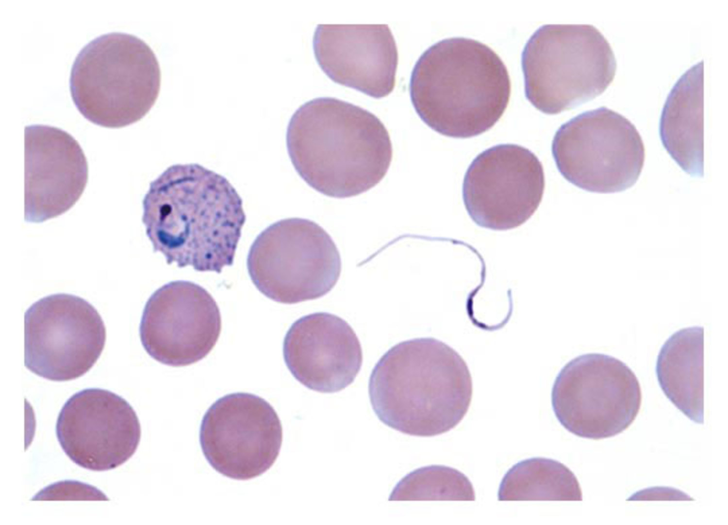 Plasmodium vivax