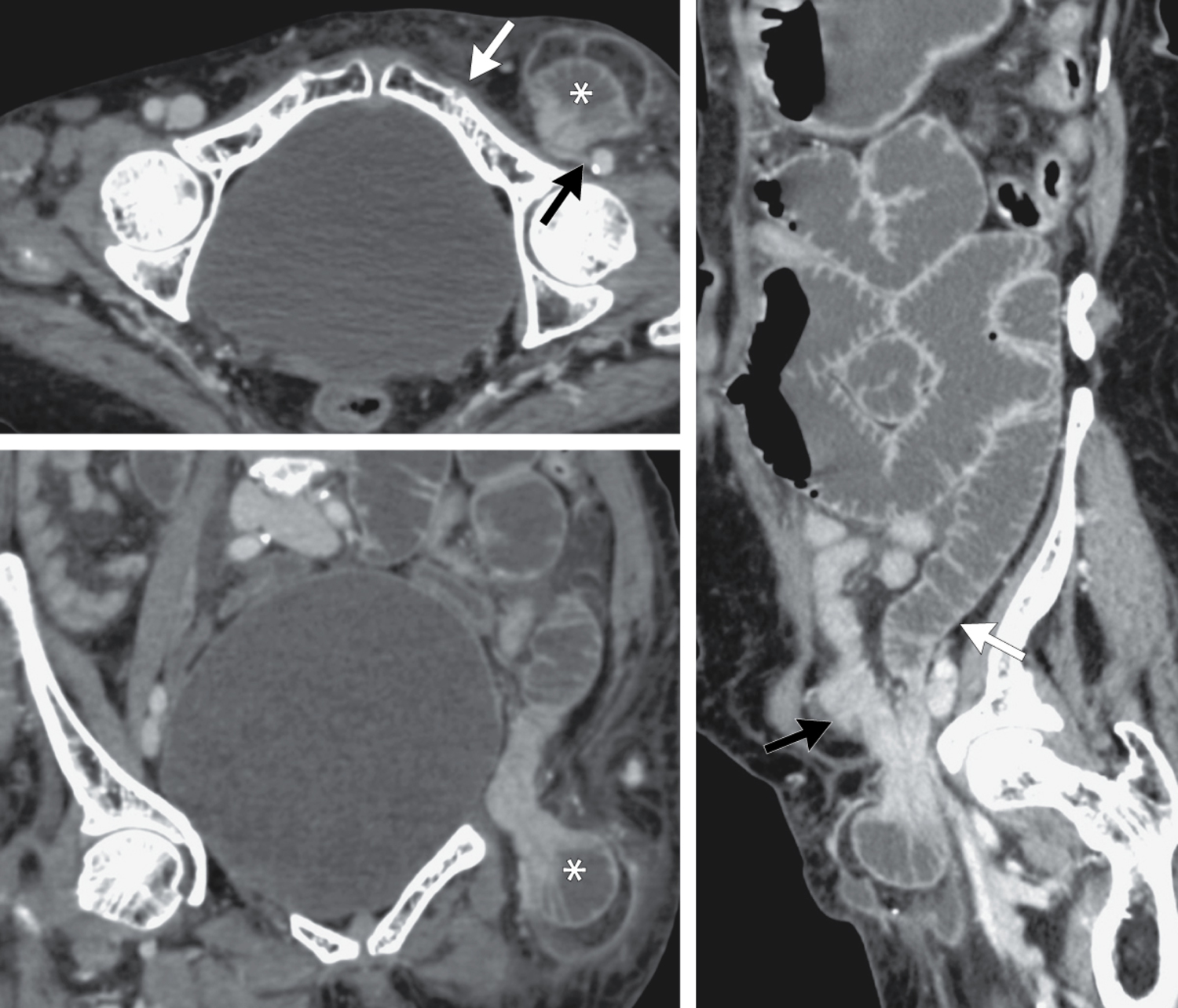 Emergent surgical repair