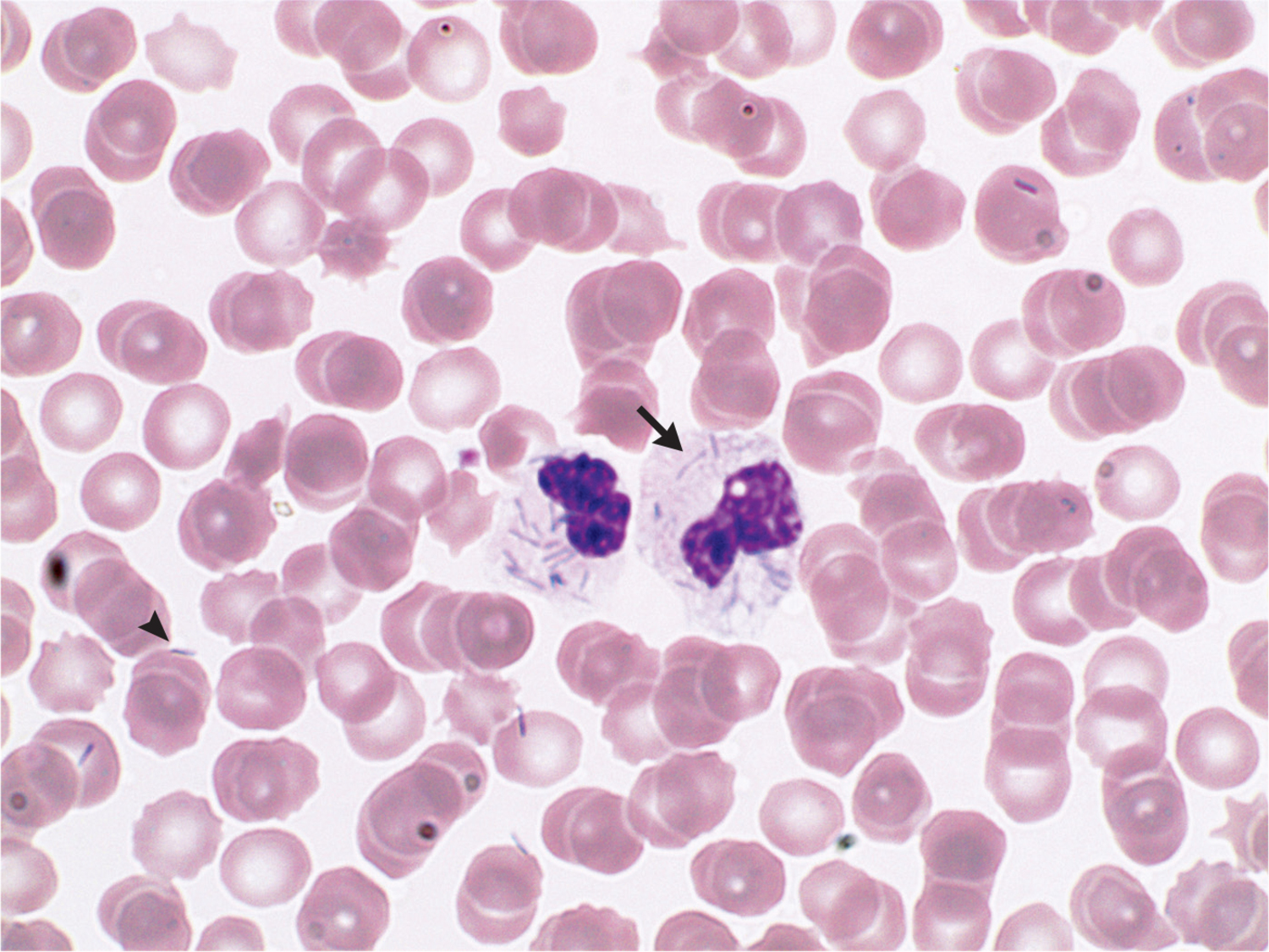 Capnocytophaga canimorsus