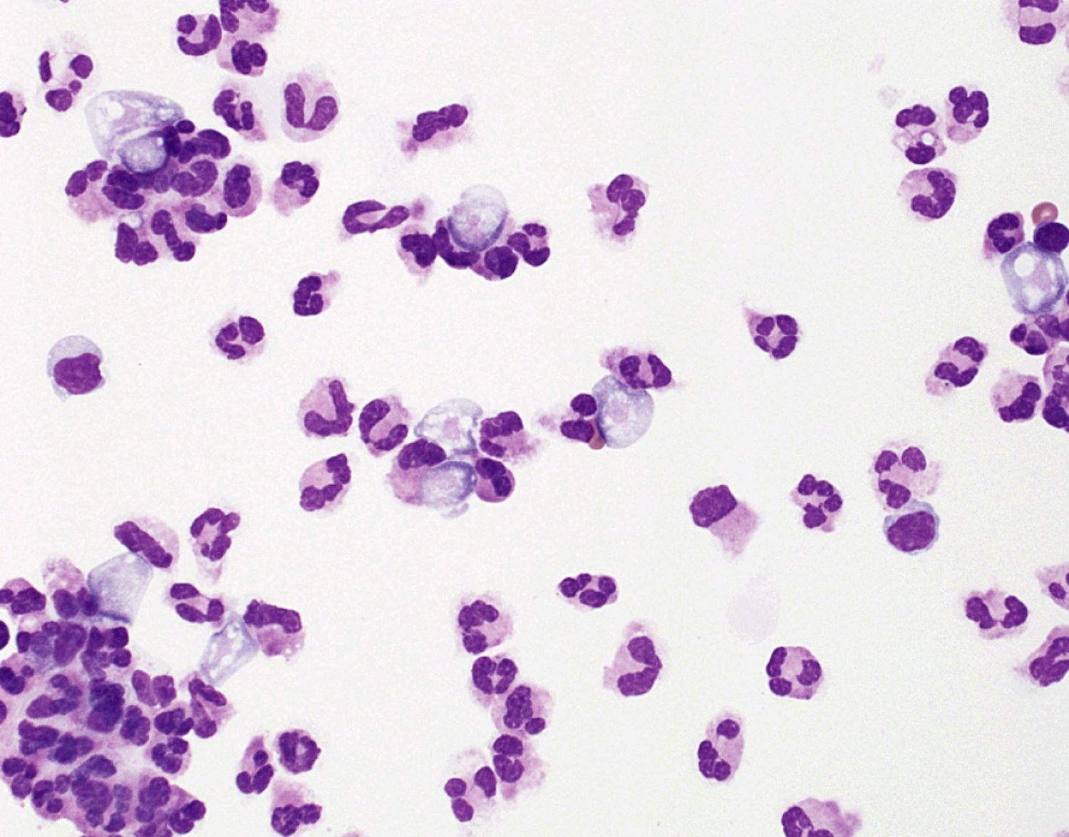 Naegleria fowleri