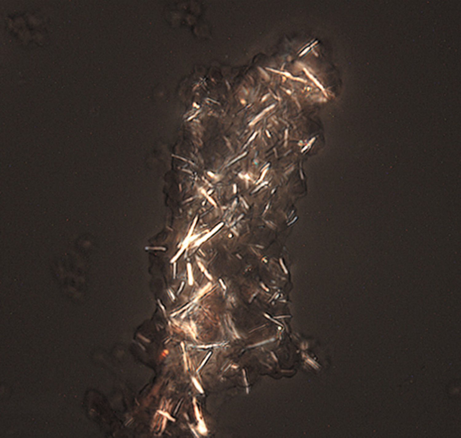 Monosodium urate