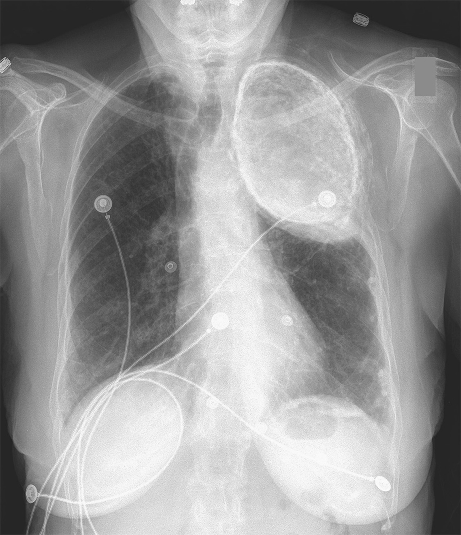 Oleothorax