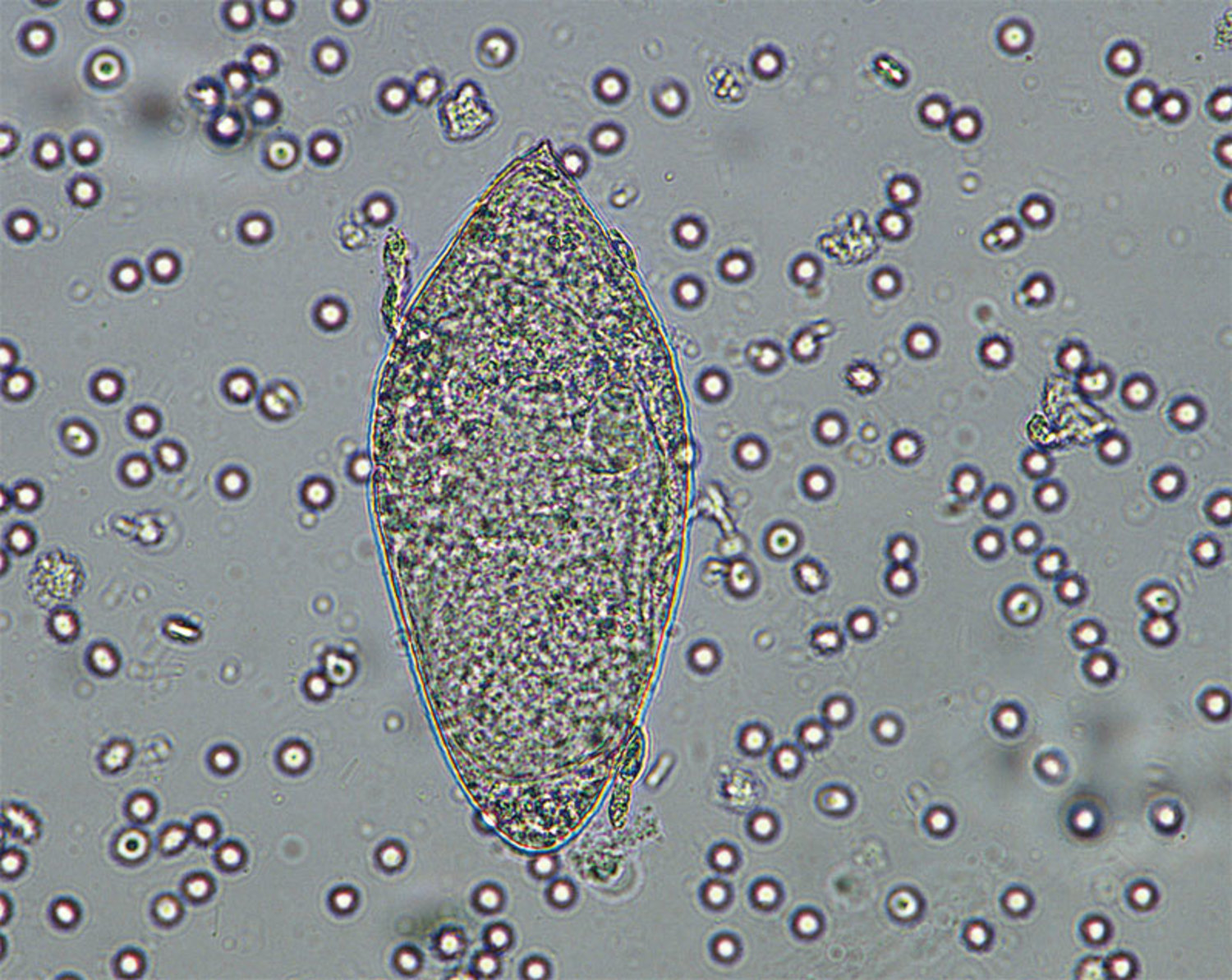 Praziquantel
