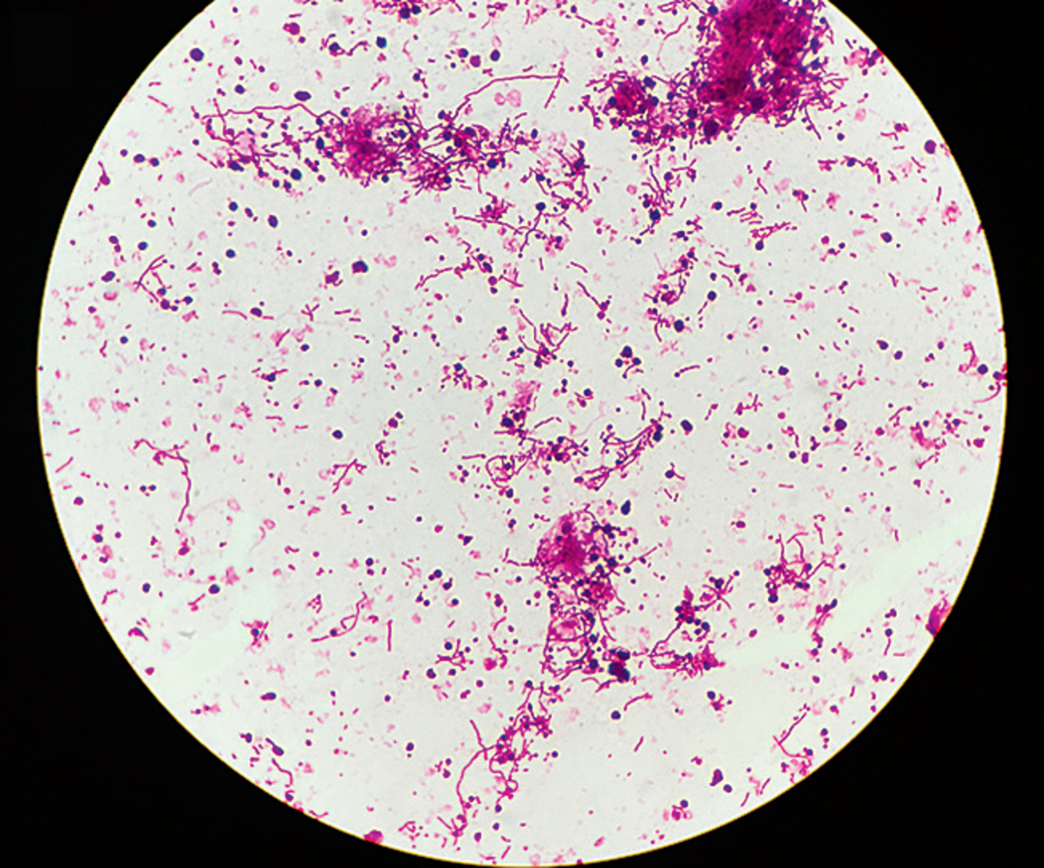 Fusobacterium necrophorum