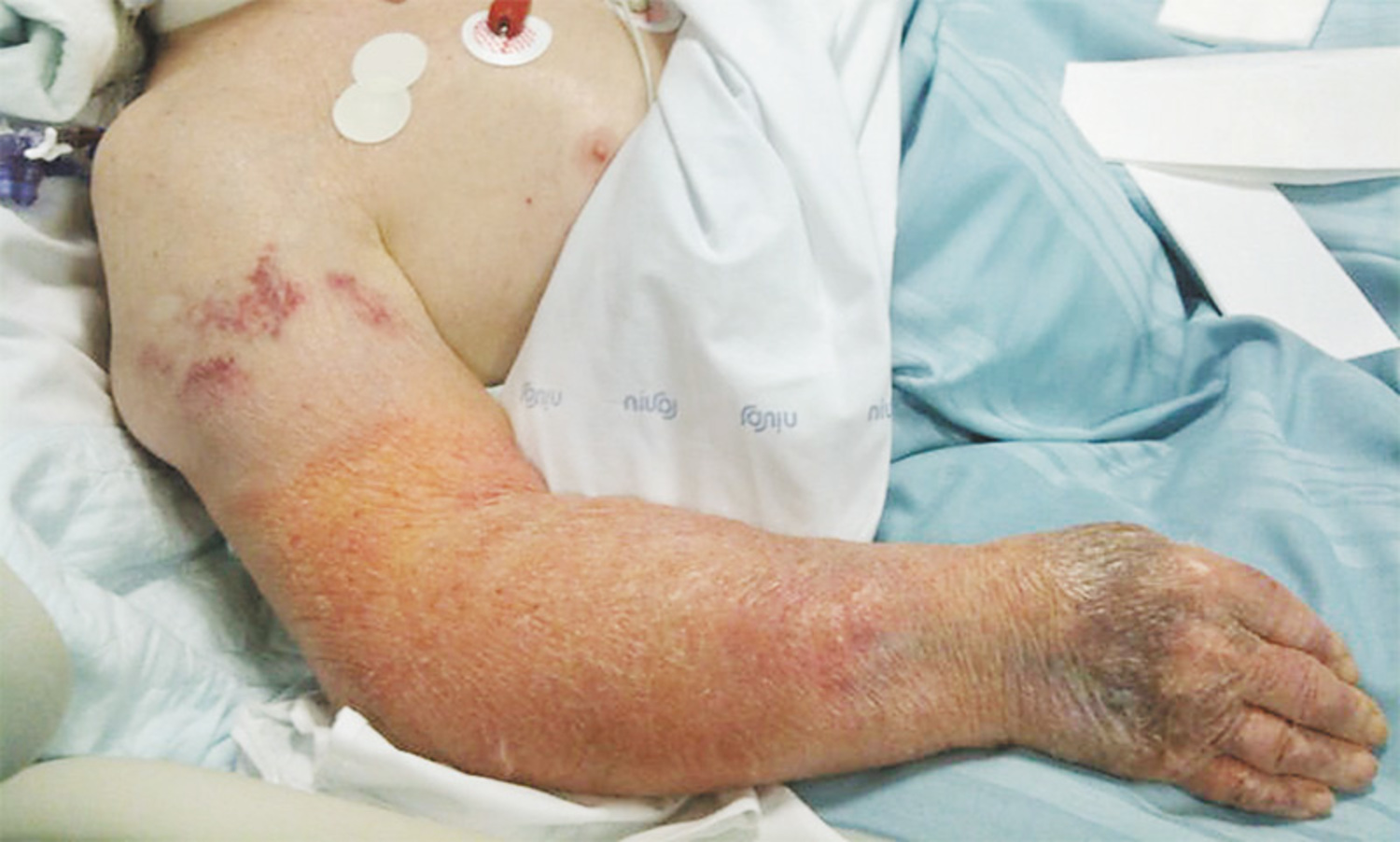 Niacin